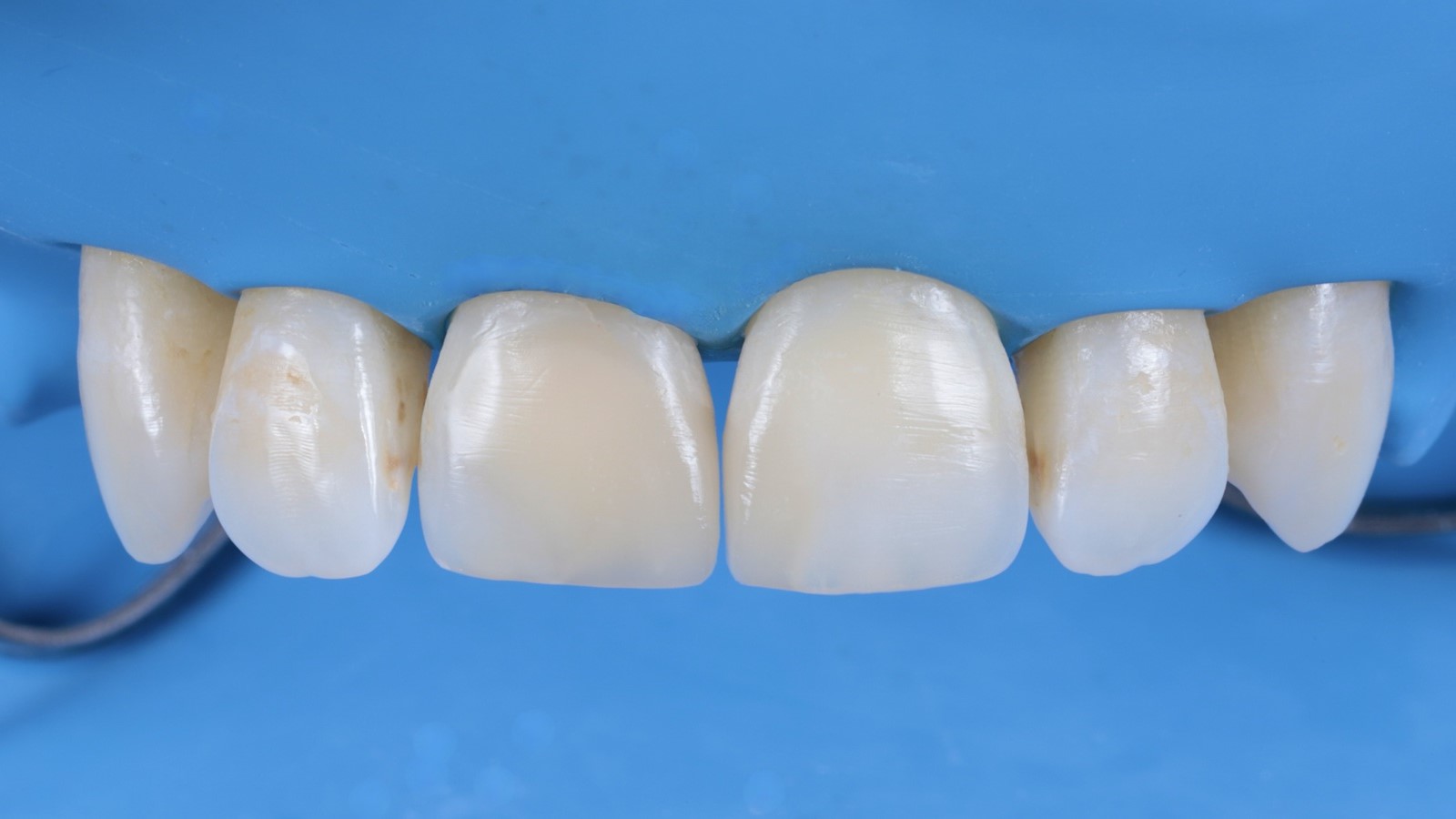 Step 8: Final polishing under the dam