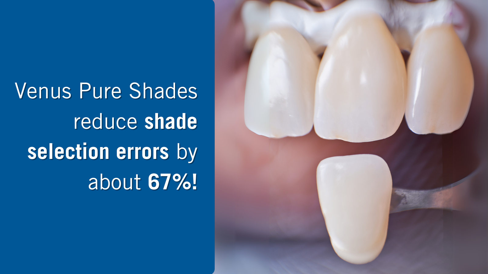 Study confirms: Simplified layering, pleasing results