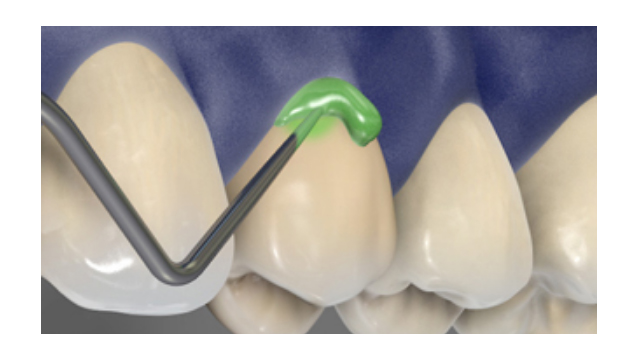 Preventive materials