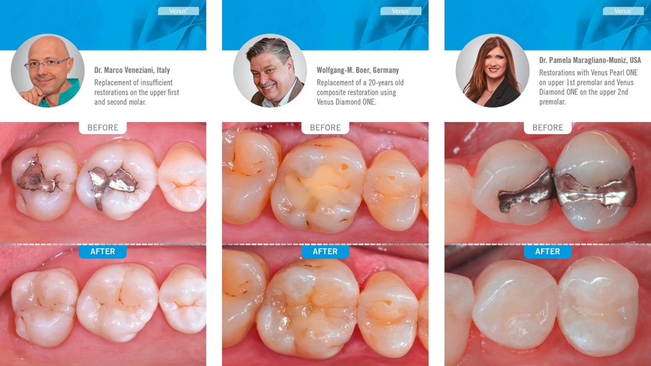 Venus ONE cases & voices