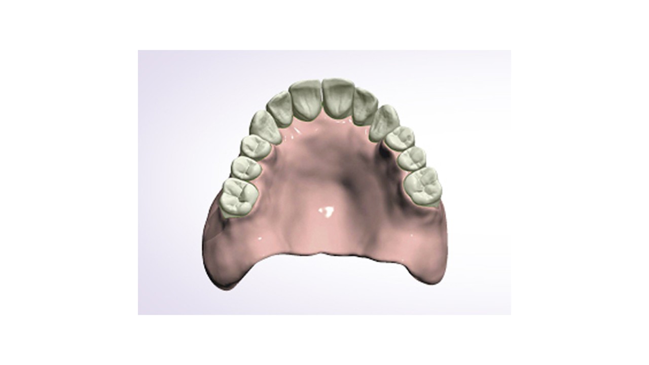 Denture Design™