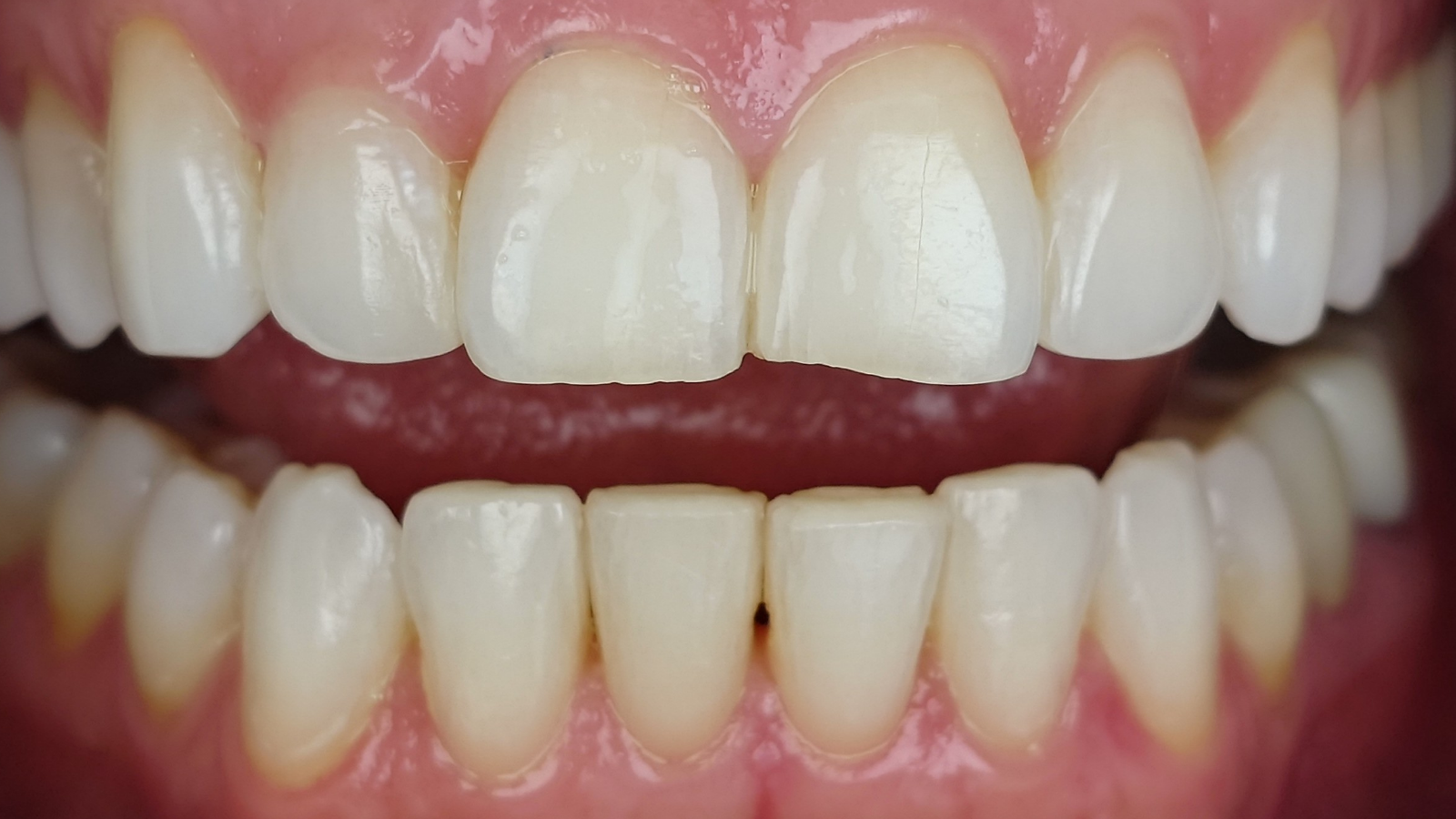 Click and hold the green slider. Move from side to side to reveal the before-and-after pictures.