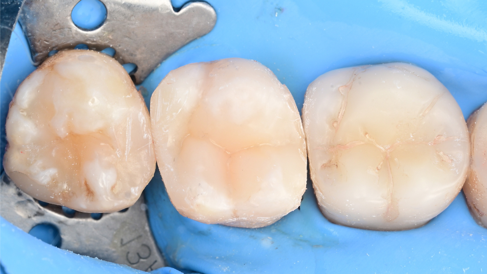Case 1