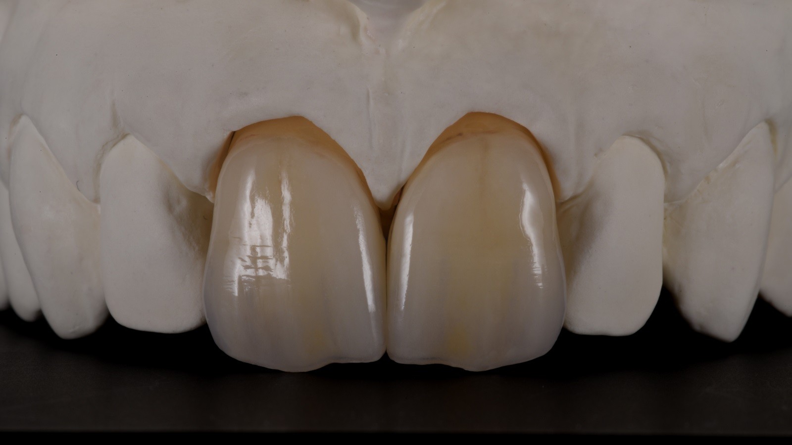 Excellent results