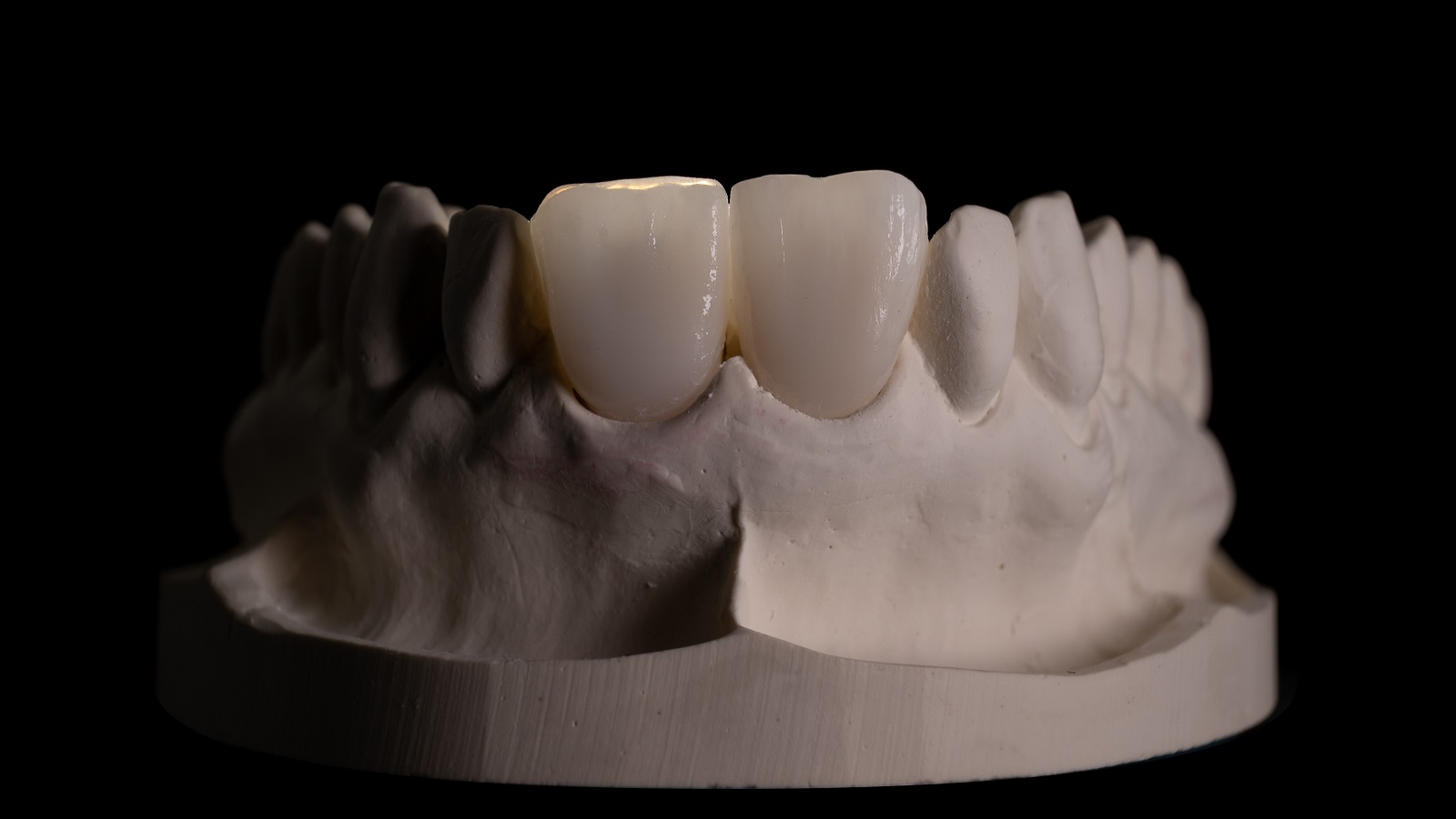 Result after HeraCeram cre-active 3D Firing.
