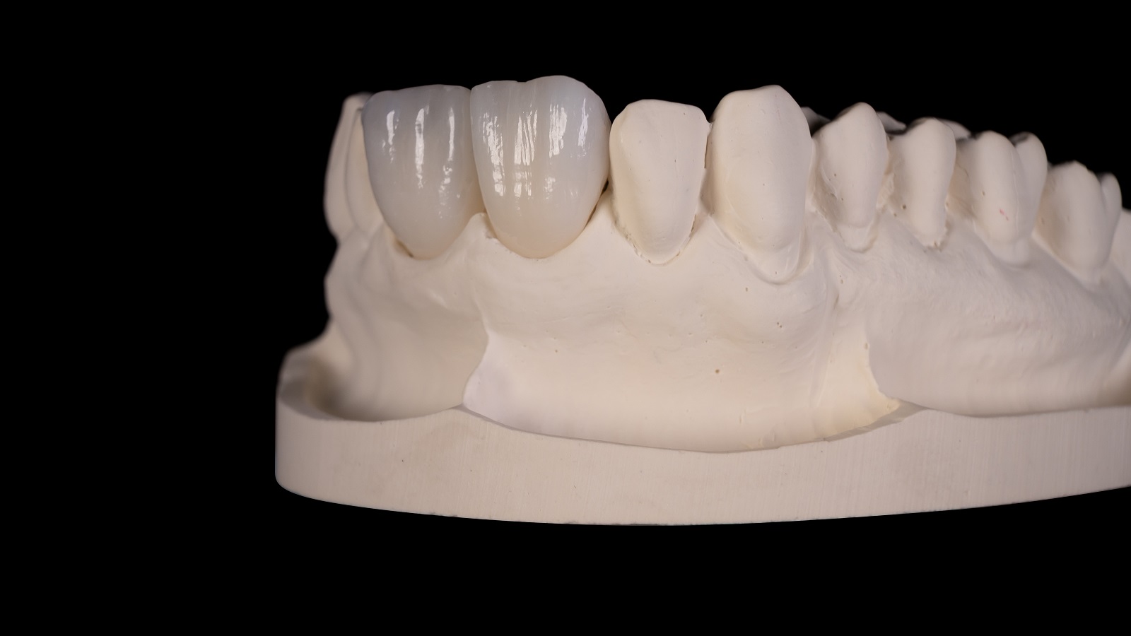Final result after HeraCeram cre-active 2D firing