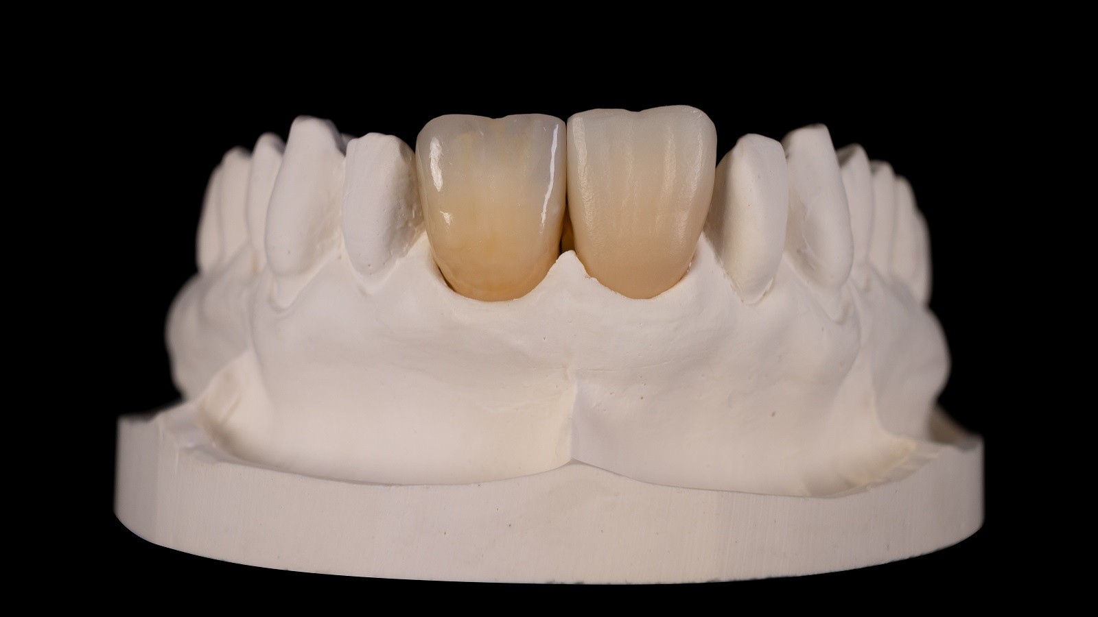 Final result after HeraCeram cre-active 2D Firing
