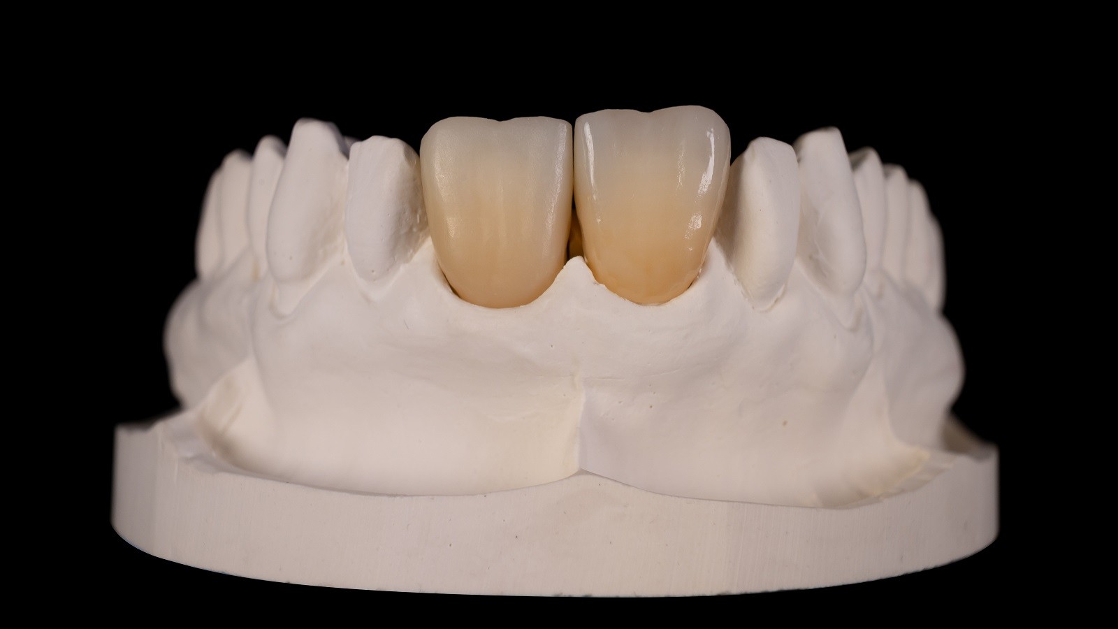 Links: Ausgang - rechts: standard Schichtung