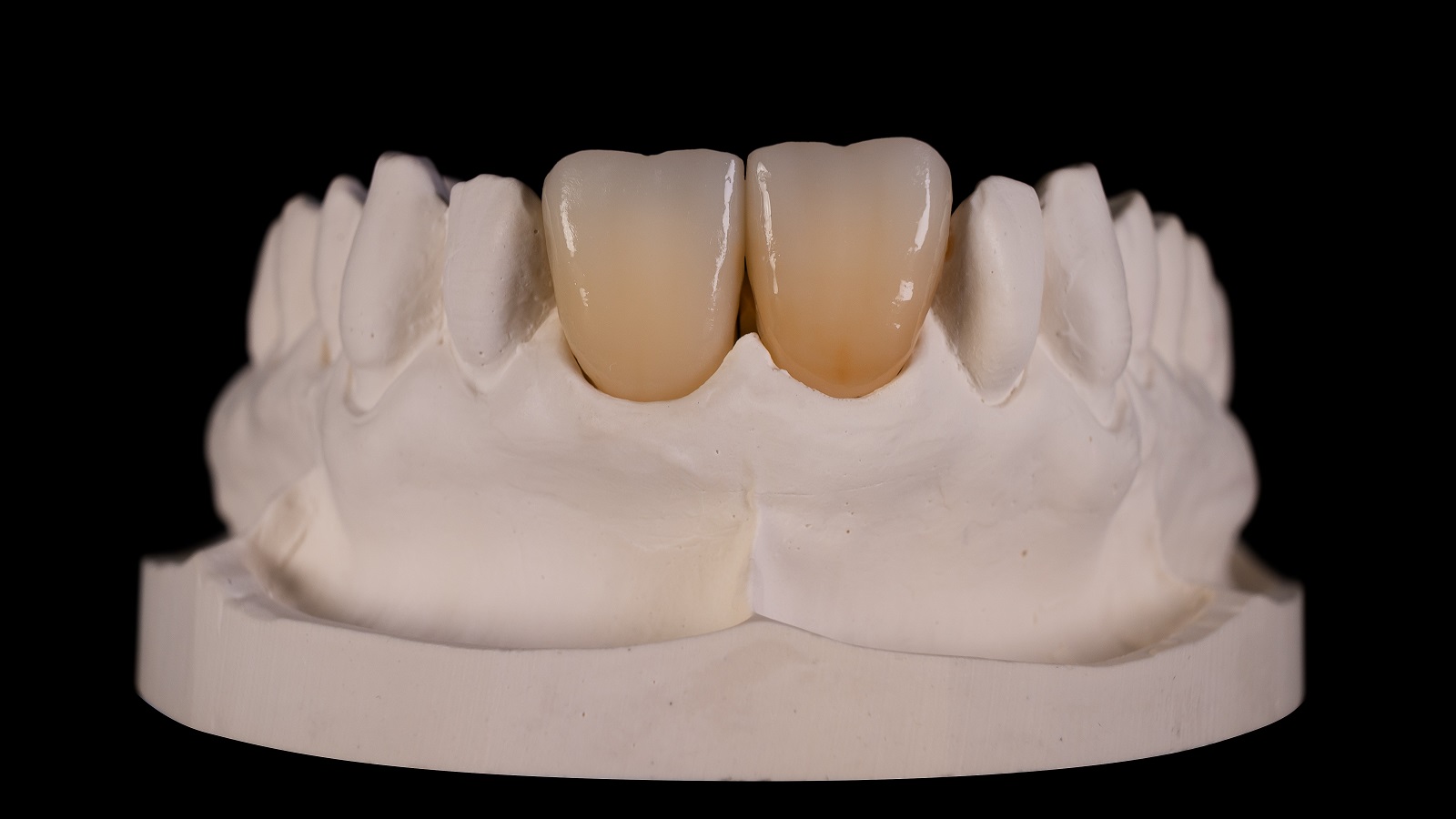 Thinly coat the surface with HeraCeram cre-active Glaze
