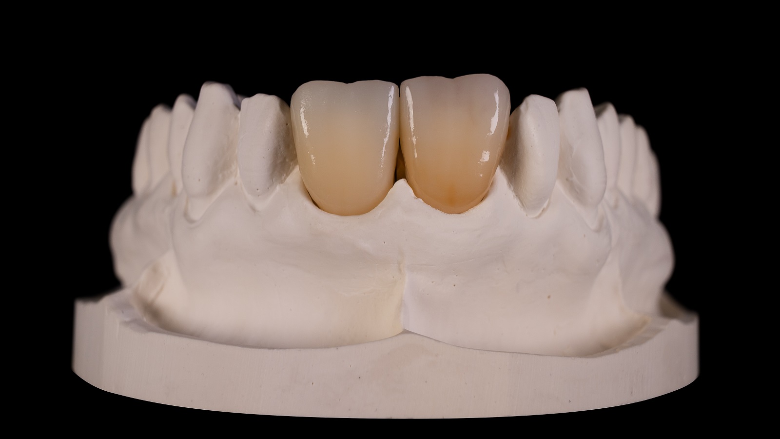 HeraCeram cre-active 2D Aubergine