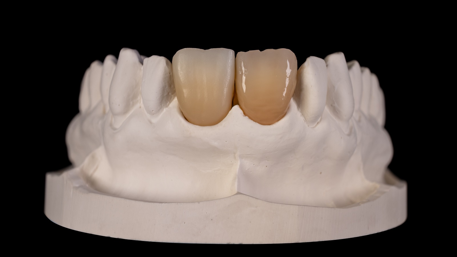 Apply a thin layer of HeraCeram cre-active Glaze Fluo over the entire surface