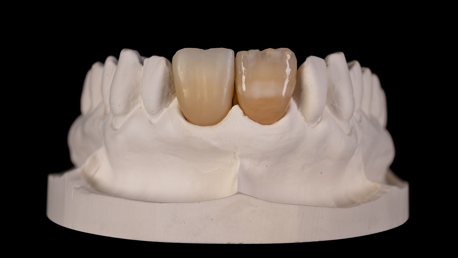 HeraCeram cre-active - Magic matrix concept