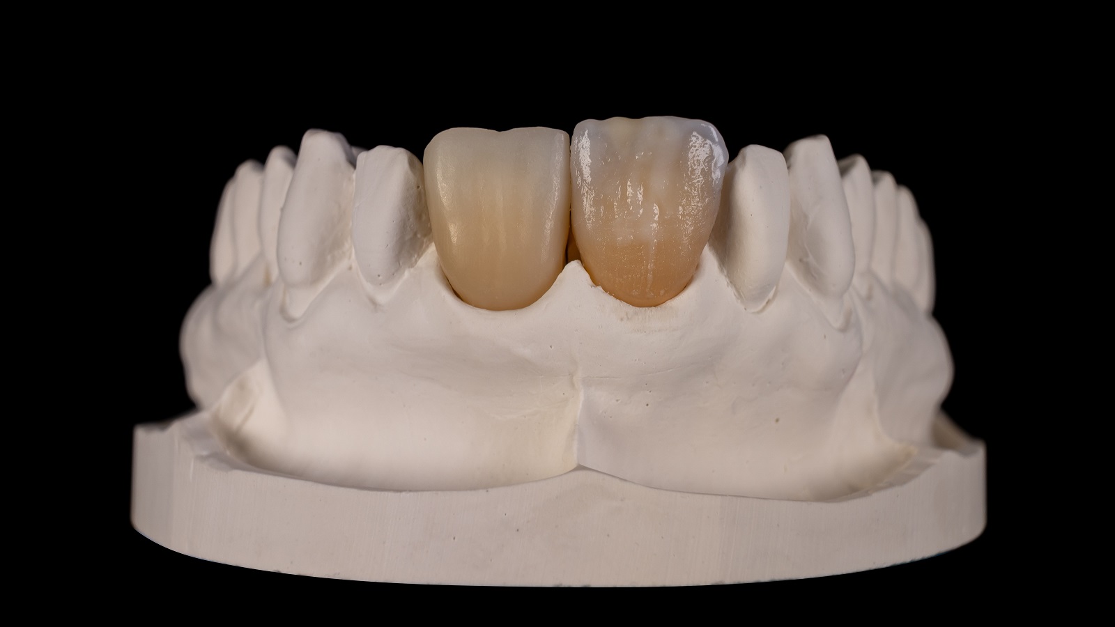 HeraCeram cre-active - Magic matrix concept