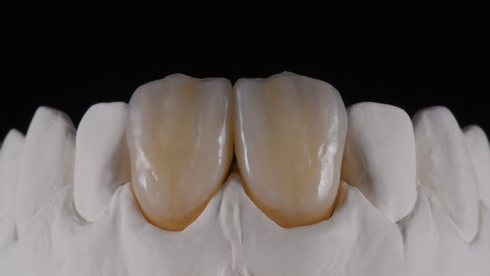 HeraCeram cre-active - take two concept