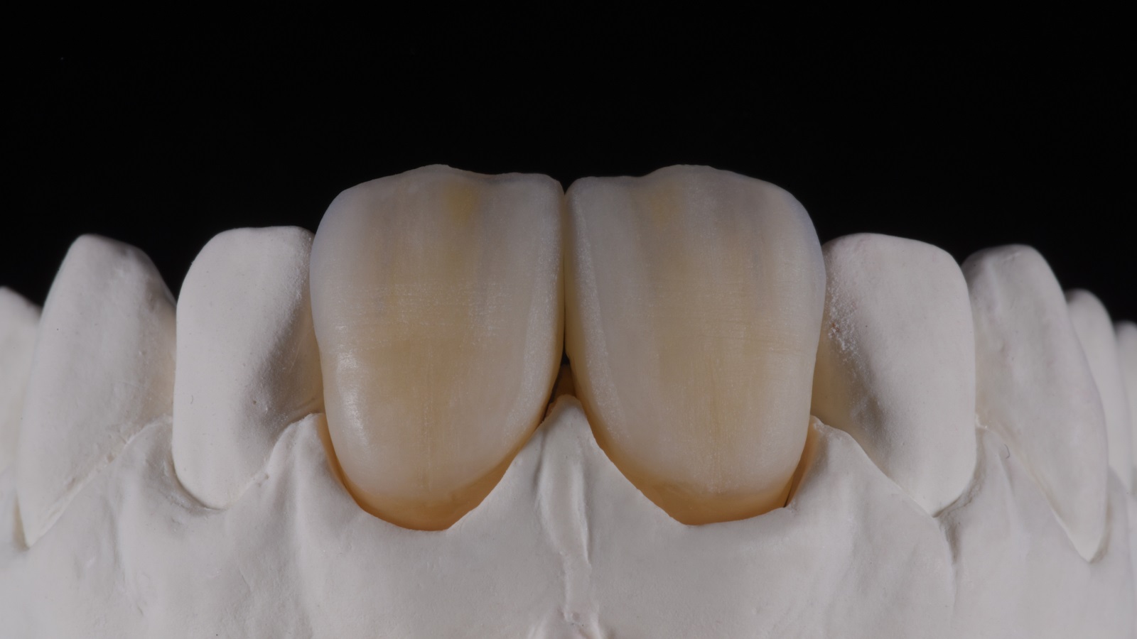 HeraCeram cre-active - take two concept