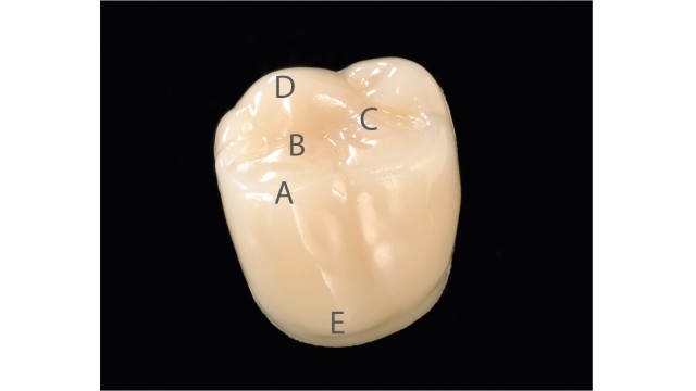 Posterior tooth