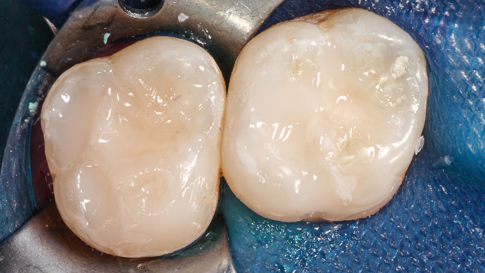 Click and hold the green slider. Move from side to side to reveal the before-and-after pictures