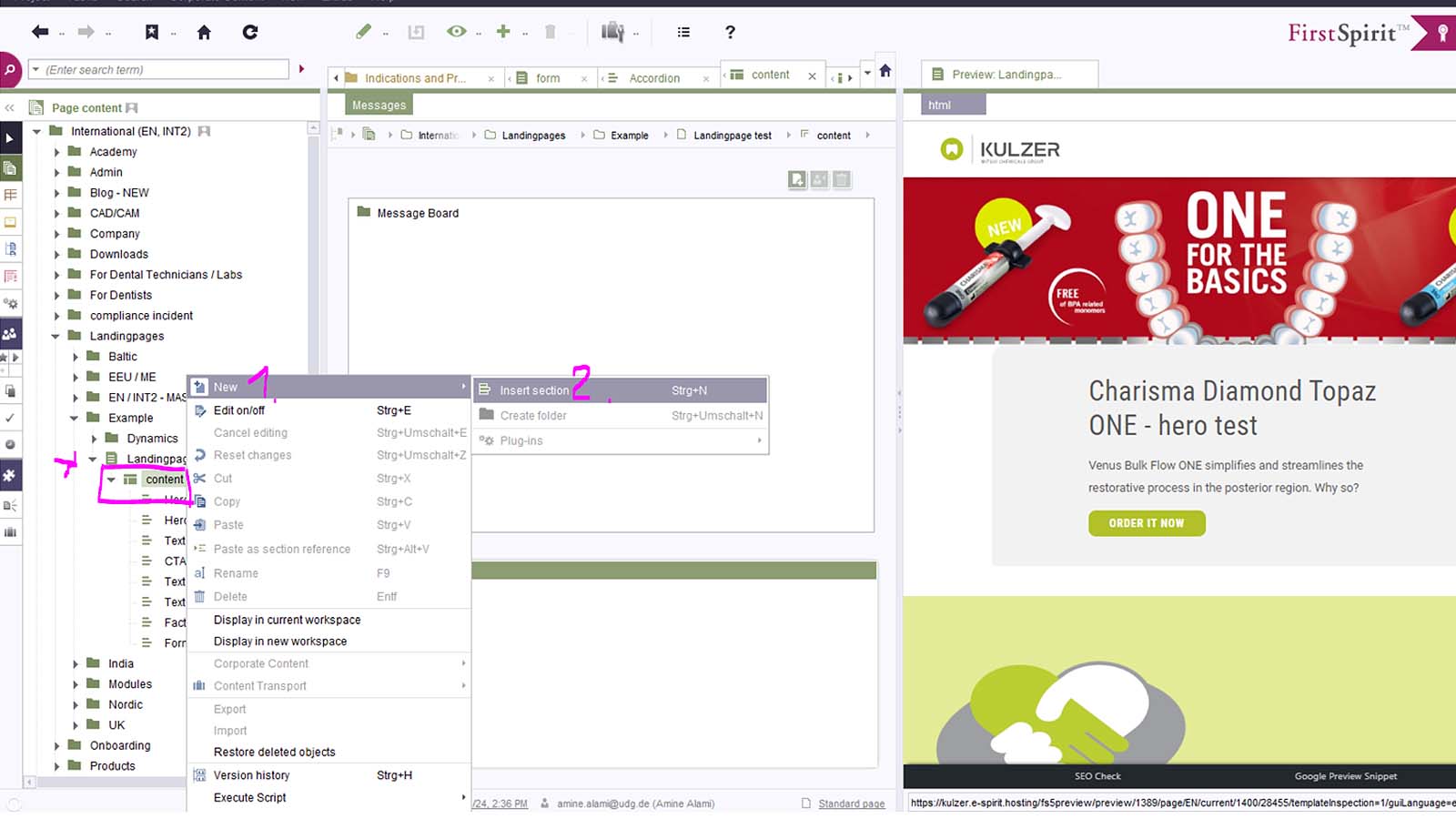 First Spirit: Inserting Modules