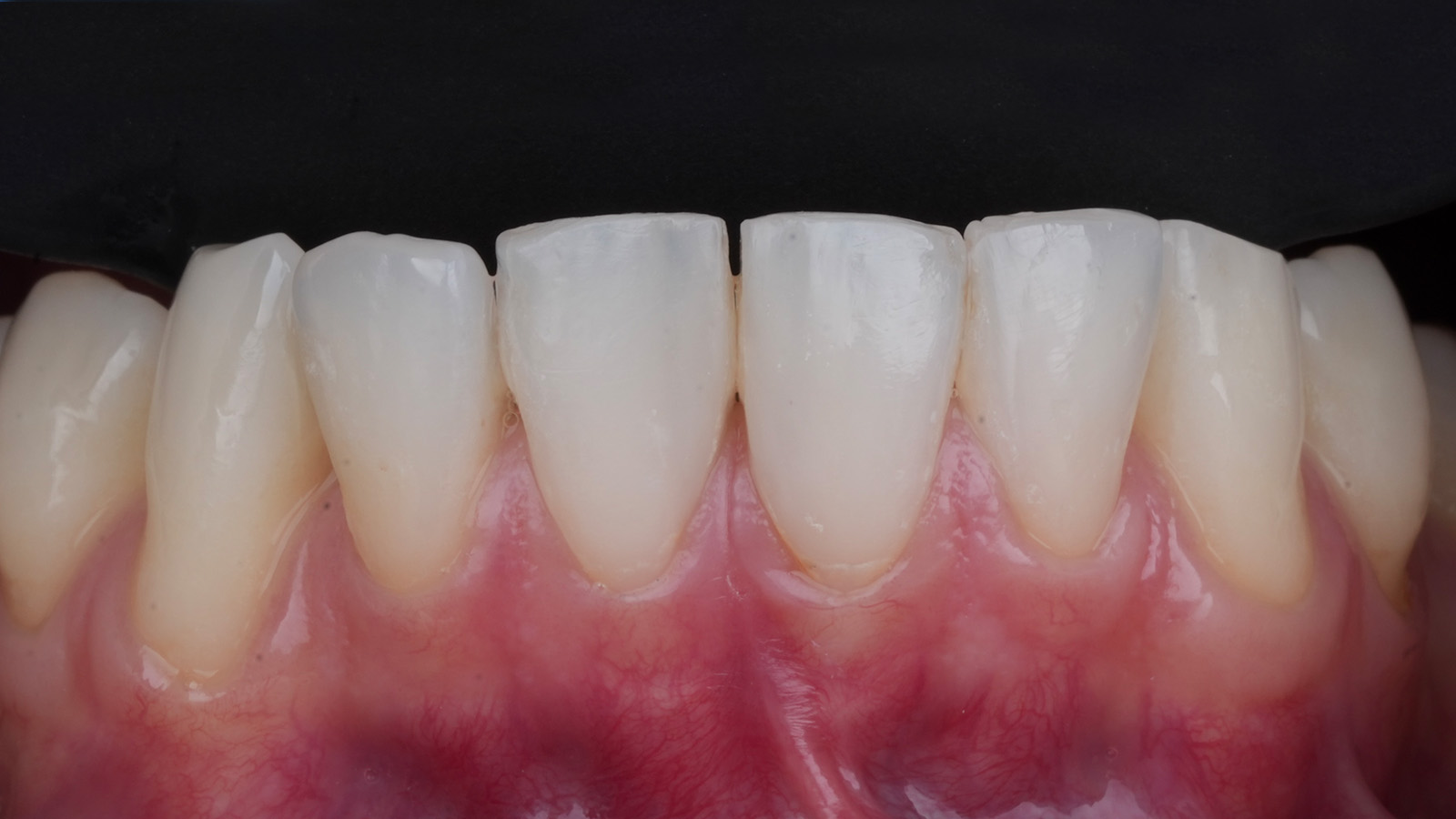 Click and hold the green slider. Move from side to side to reveal the before-and-after pictures.