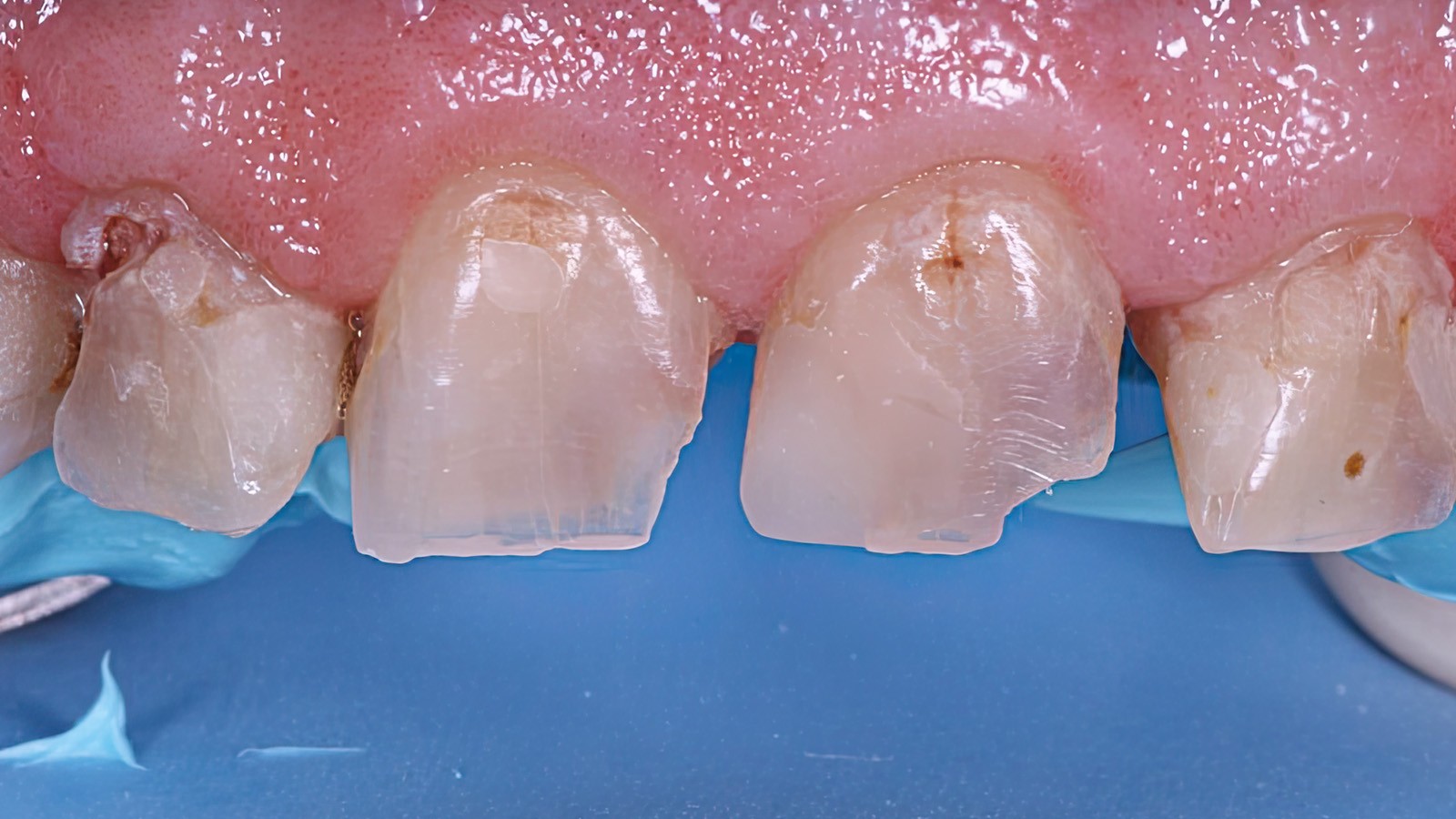 Click and hold the green slider. Move from side to side to reveal the before-and-after pictures.