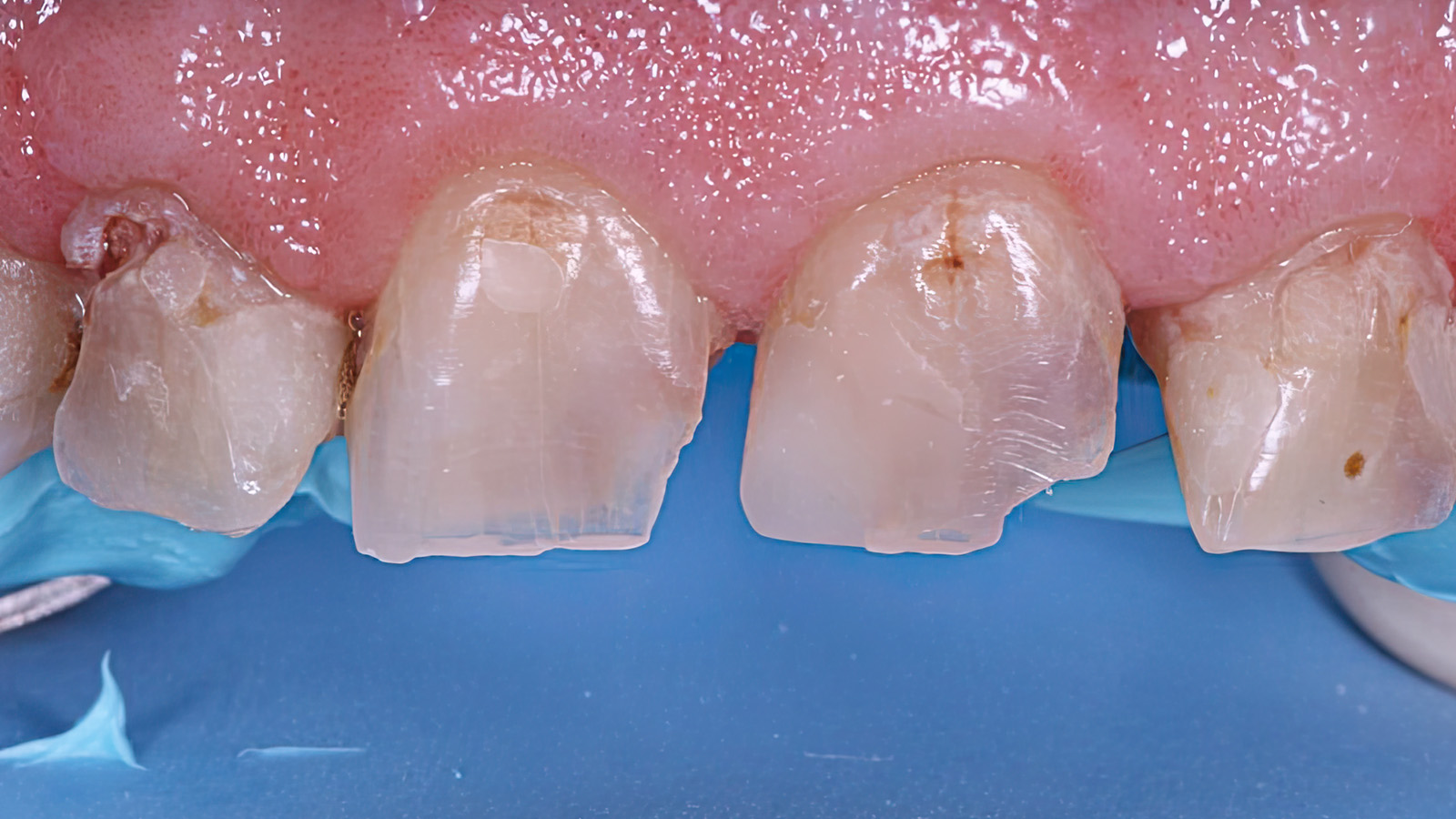 Click and hold the green slider. Move from side to side to reveal the before-and-after pictures.