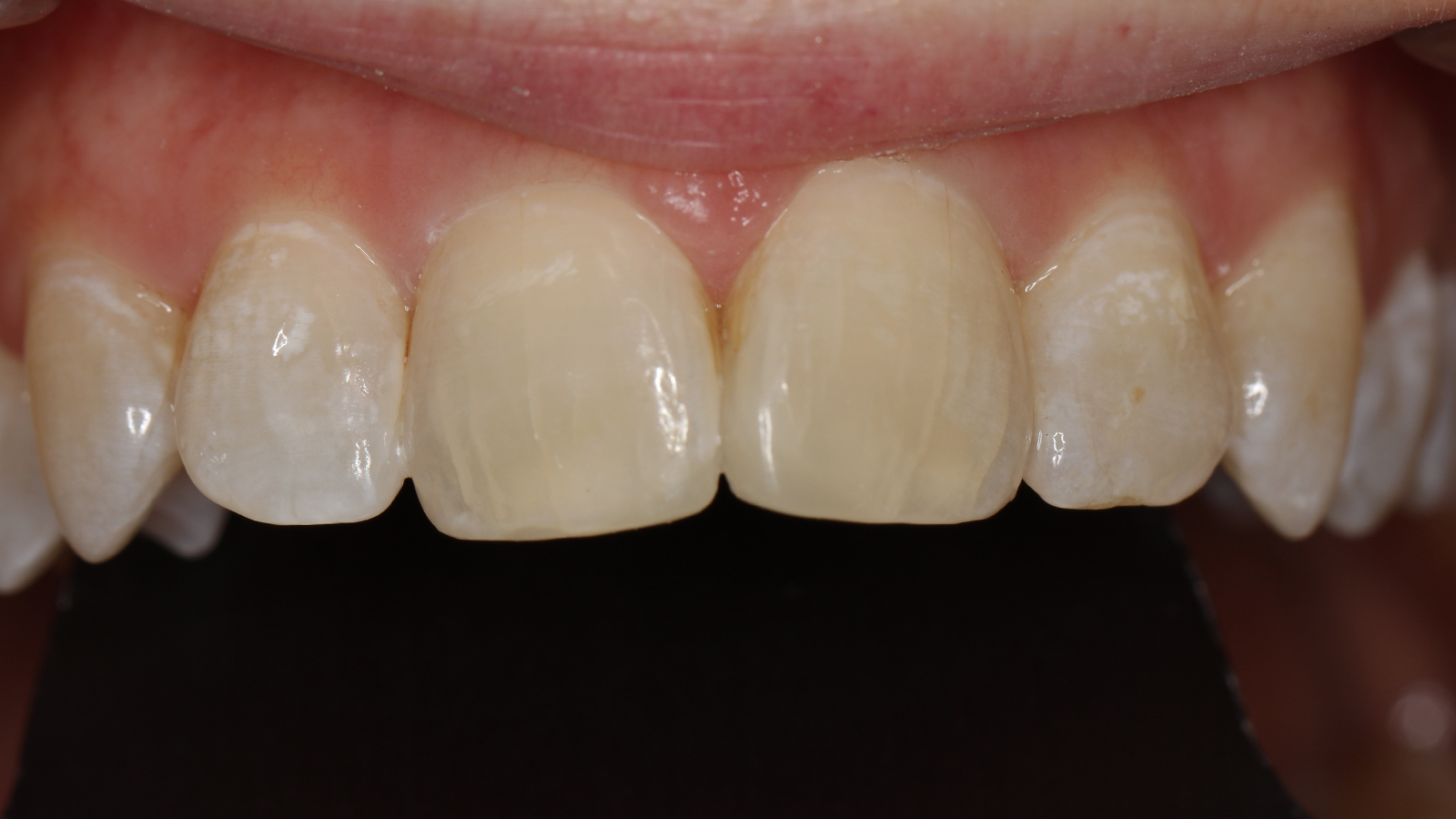 Click and hold the green slider. Move from side to side to reveal the before-and-after pictures.