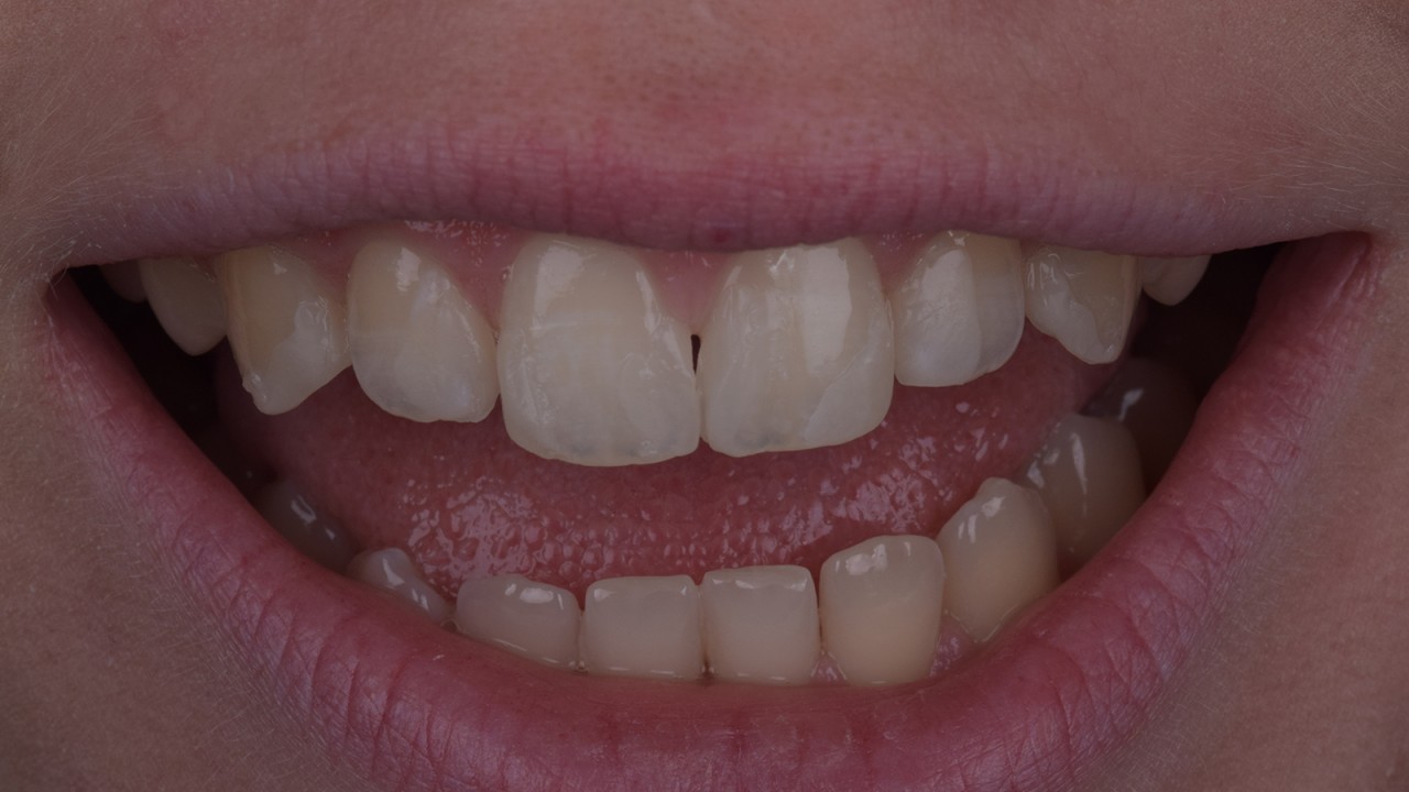 Rough direct mock-up to visualise proportions