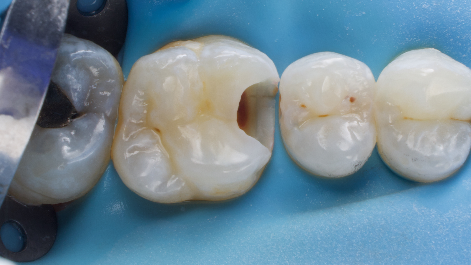 Prepared cavity